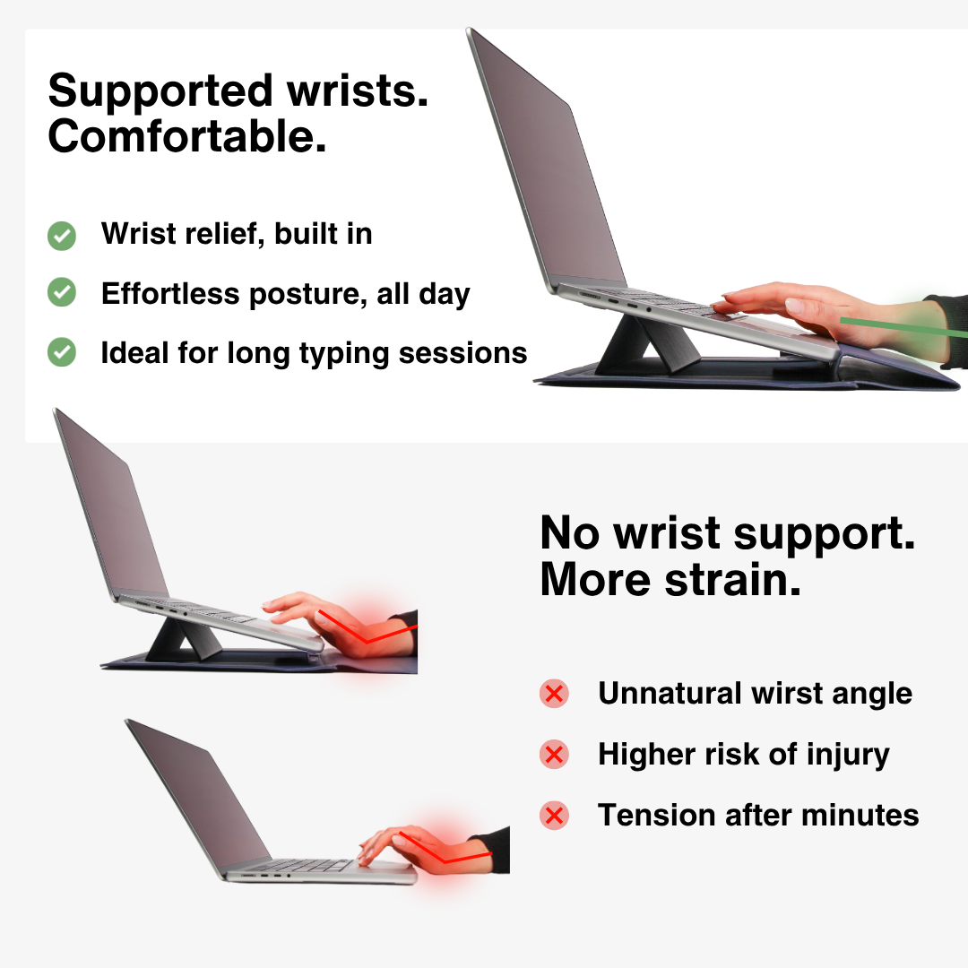 SMART SLEEVE
